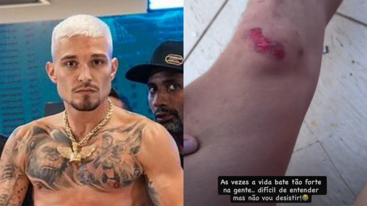 MC Gui relata novo acidente após incêndio na casa da família